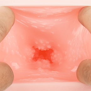 【早い人むけ】４方向にイボが広がってはいるものの、どれも存在感は希薄。細かいツブツブも知覚しにくいです。