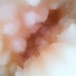 実際の撮影動画です。グチョグチョのおま○こ内部が鮮明に映し出されていますね。男性なら大興奮間違いなし！
