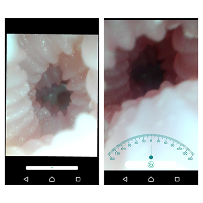 リアル系のオナホ内部を撮影した画像。スマホ画面の拡大・縮小・回転も自在です。また、細身のスティックは挿入時の負荷が低いので、アナルでも楽しめそうですね。